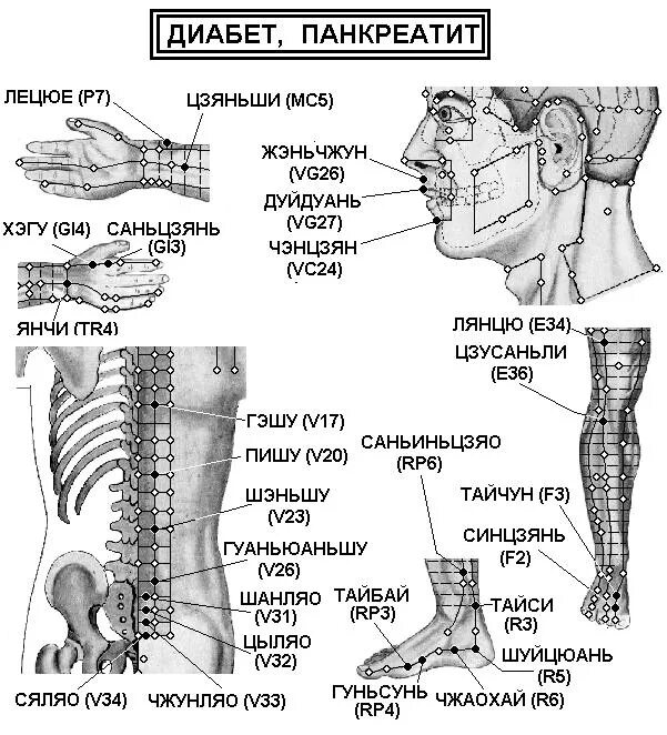 Акупунктурные точки при сахарном диабете 2 типа. Комплекс упражнений для больных сахарным диабетом 2 типа. Лечебный массаж стопы. Лечебный массаж ног. Точки акупунктуры при инсульте.