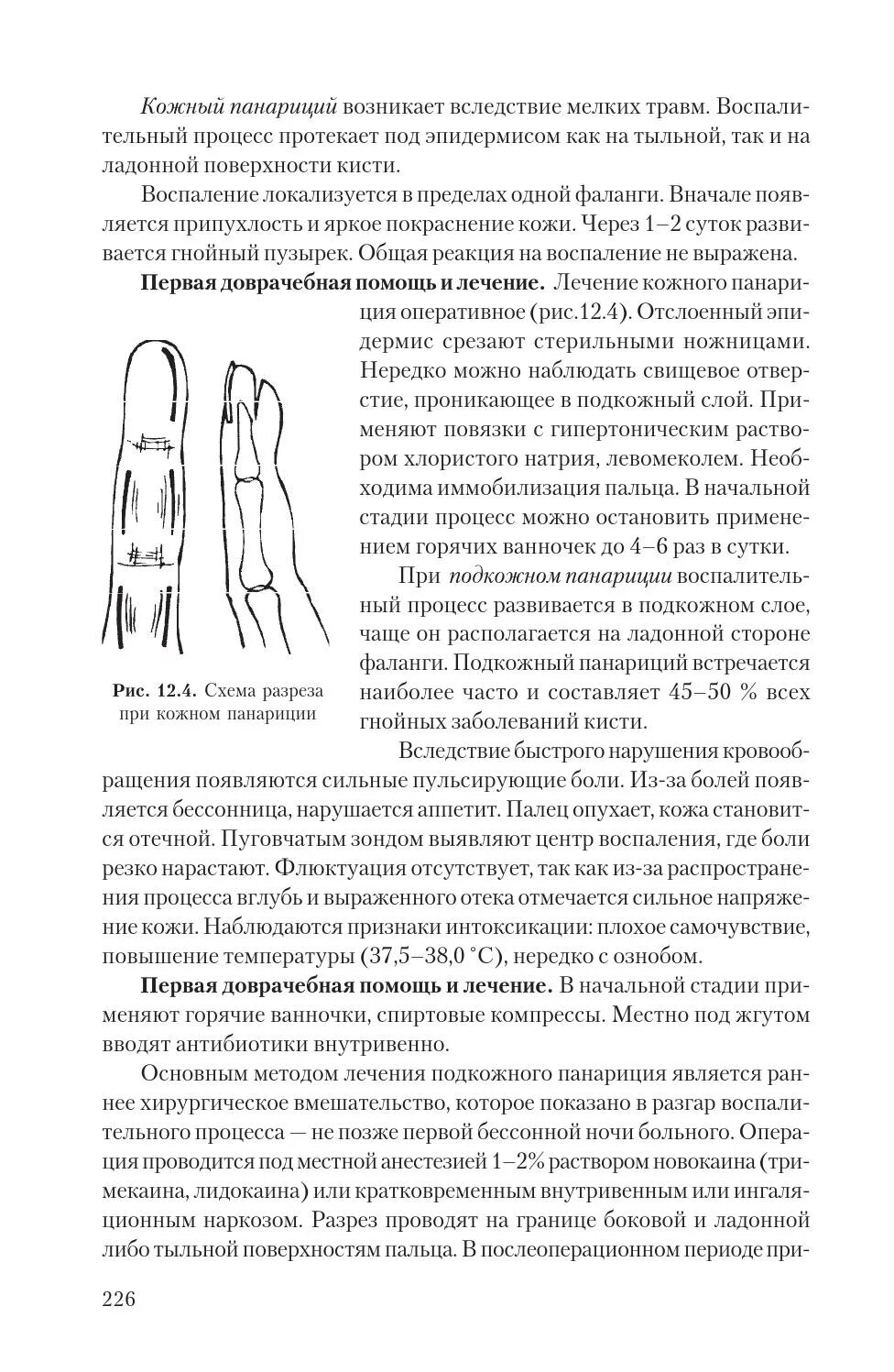 Методы обследования при панариции. Панариций клиническая картина. Панариций мазь отзывы. Панариций мазь отзывы. Синтомицин мазь.