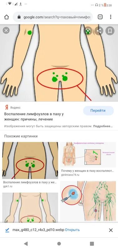 Лечение лимфоузлов в паху у женщин. Лечение лимфоузлов в паху у женщин