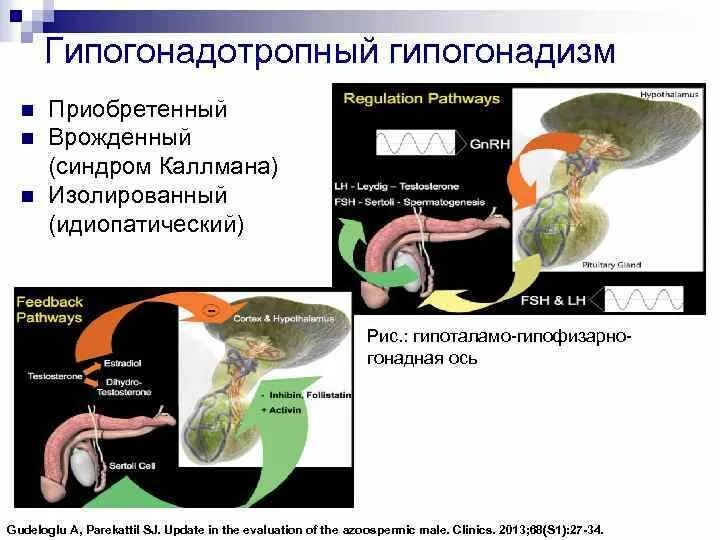 Классификация гипогонадизм мужской. Гипогонадотропный гипогонадизм у мужчин. Гипогонадотропный гипогонадизм у мужчин. Гипогонадотропный гипогонадизм у мужчин. Первичная гипофункция яичников.