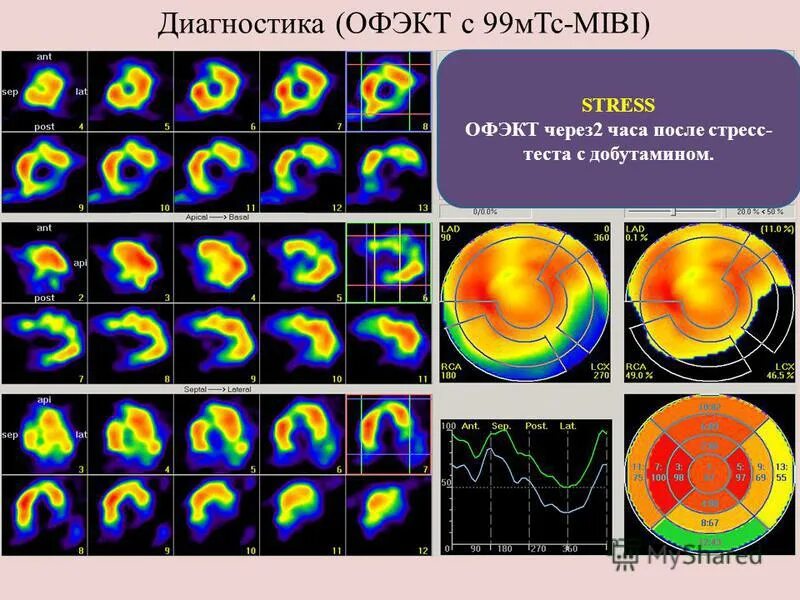 Листовка мтс. Г. Мтс супер мтс. Mts 99. Мтс украiна.