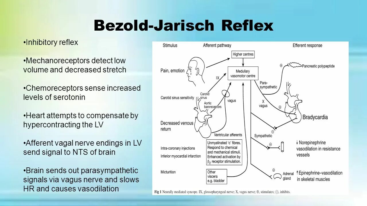 Рефлекс Bezold-Jarisch. Рефлекс Бецольда Яриша. Reflex Syncope. Рефлекс Бецольда Яриша механизм.