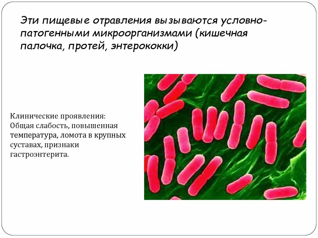 Человек кишечная палочка тип взаимодействия. Кишечная палочка Протей. Отравление кишечной палочкой. Кишечная палочка условно патогенная.