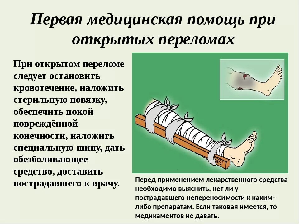 Виды переломов и первая помощь при них. Открытый перелом кости первая помощь. Оказания первой медицинской помощи при открытых переломах костей. Первая помощь при открытом переломе конечностей. ПМП при открытом переломе.