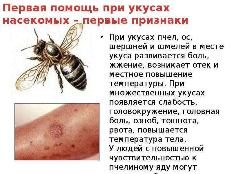 Сколько жалит оса