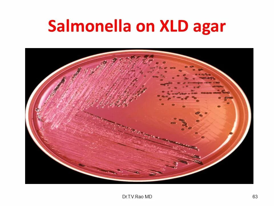 Spp salmonella spp shigella spp