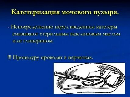 Введение уретрального катетера
