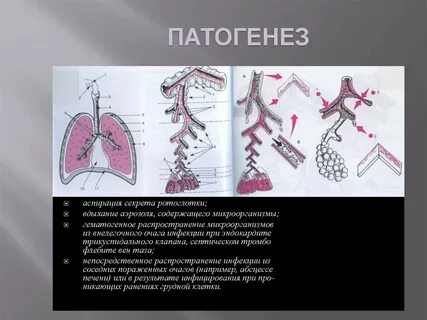 Аспирация это в медицине