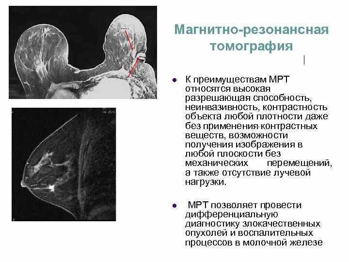 Мрт грудных желез с контрастом: найдено 89 картинок