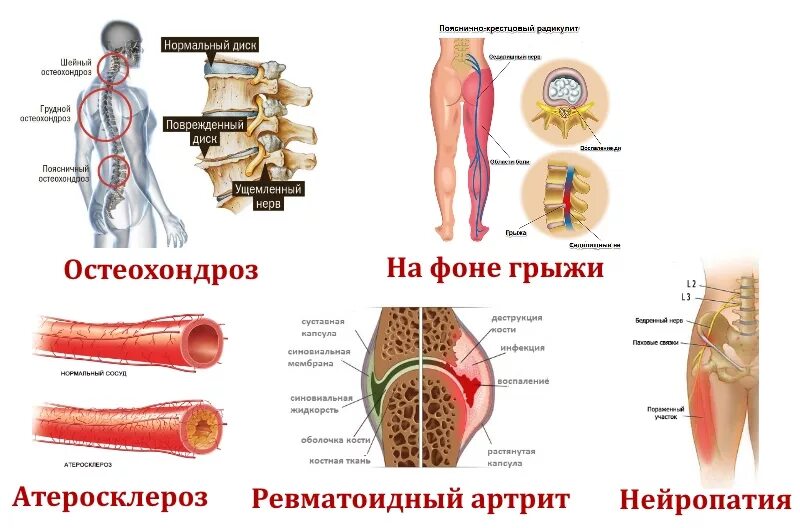 Немеют ляшки