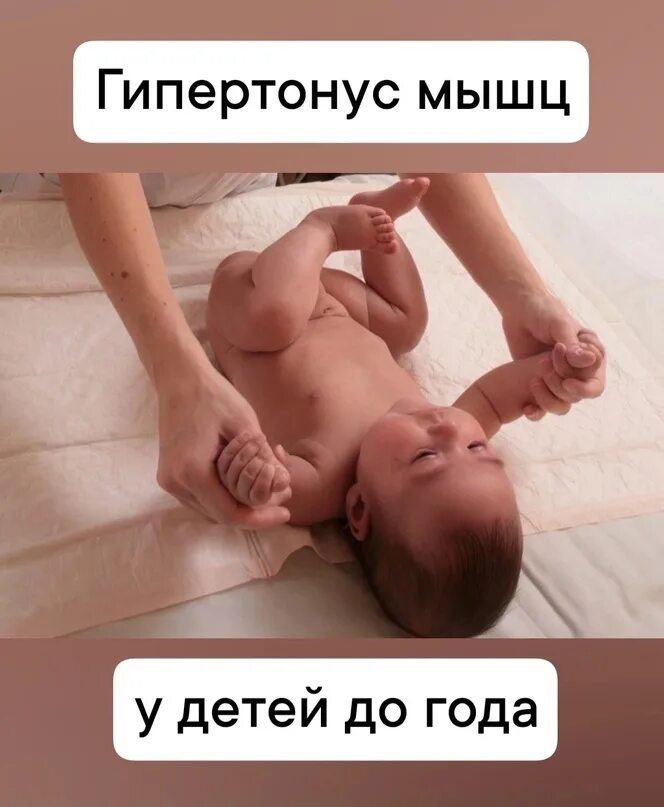 Тонус у ребенка симптомы. Гипертонус у детей до года. массаж при гипертонусе ножек. детский массаж при гипертонусе. гипертонус мышц у новорожденных.