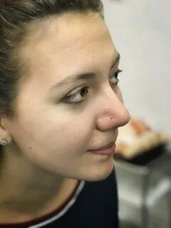 Быстро ли зарастает