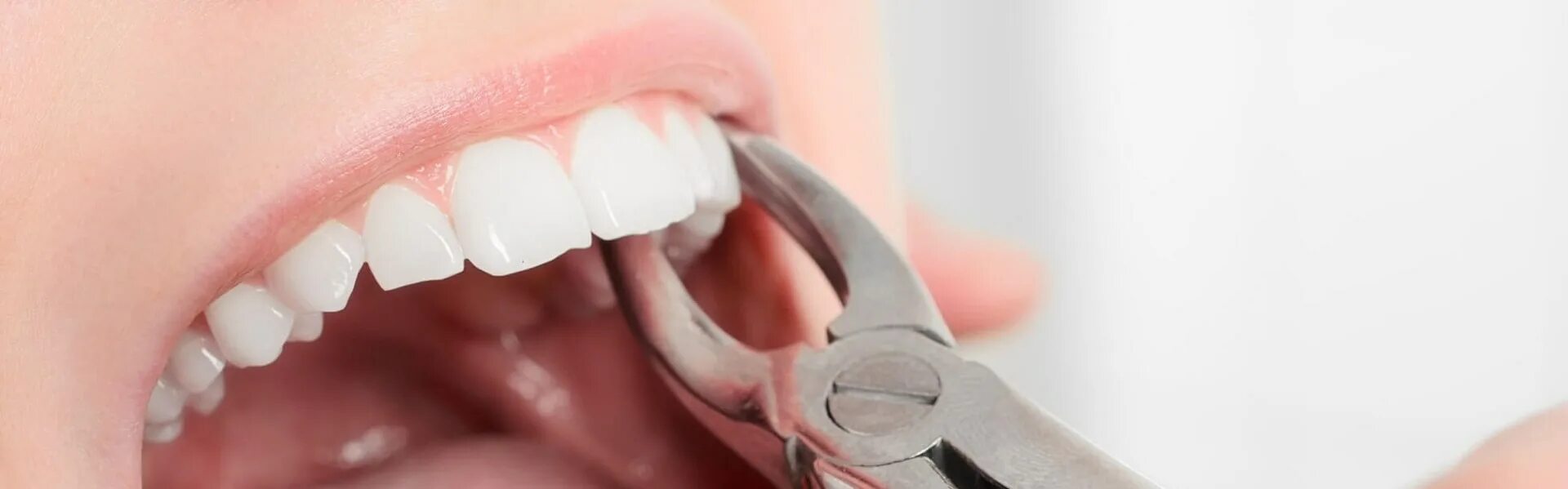 Удалить резцы. Моляры премоляры резцы клыки у человека. Этапы удаления корня зуба щипцами. Резекция верхушки корня зуба на нижней челюсти. Удалить резцы.