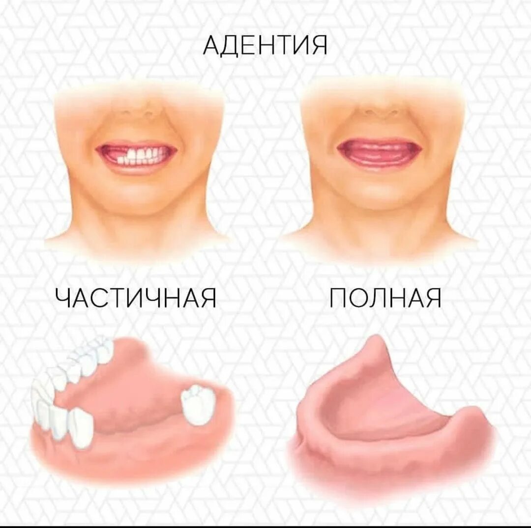Губы после протезирования