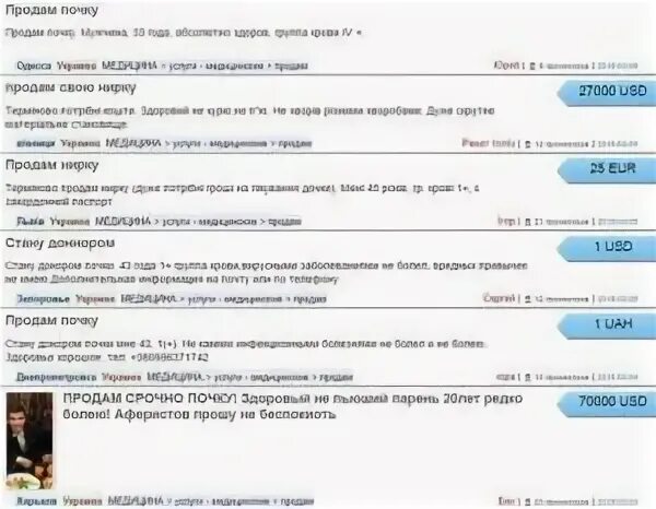 Где продать почку