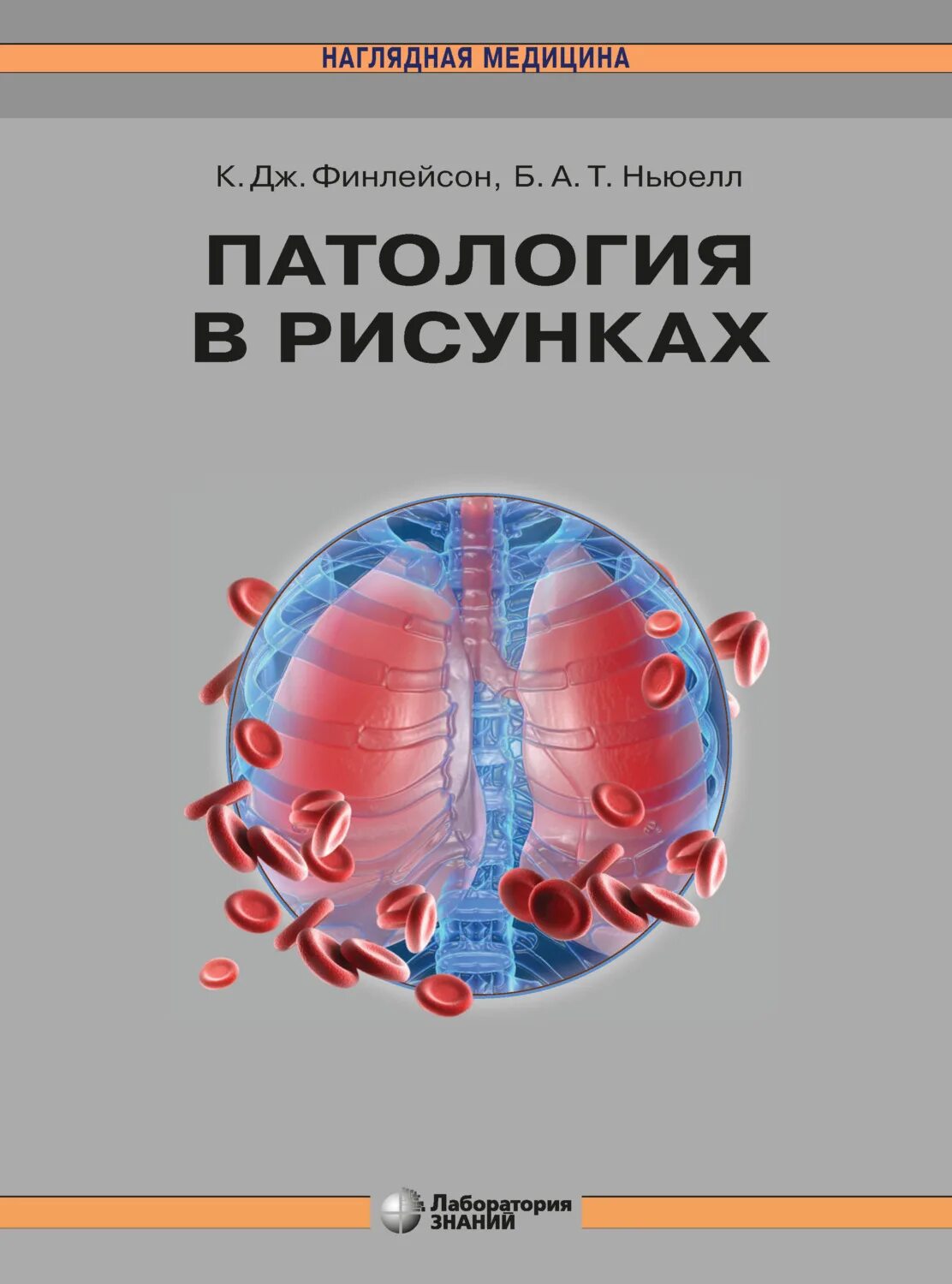 Патология картинки. Патология в рисунках Финлейсон. Патология книга.