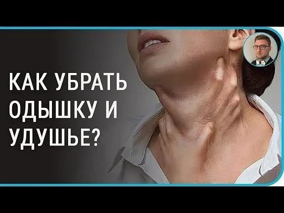 Отек ног на ранних сроках беременности: найдено 89 изображений
