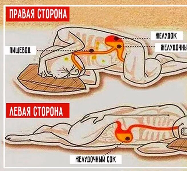 На каком боку спать ночью. Поза для сна при панкреатите. удобная поза при холецистите. на каком боку лучше спать при панкреатите и холецистите.