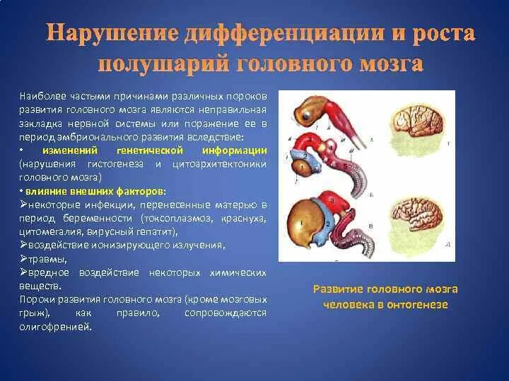 Пороки развития головного мозга. Фактор развития головного мозга. Половая дифференцировка мозга. Нарушение развития головного мозга