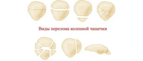 Сломанная чашечка