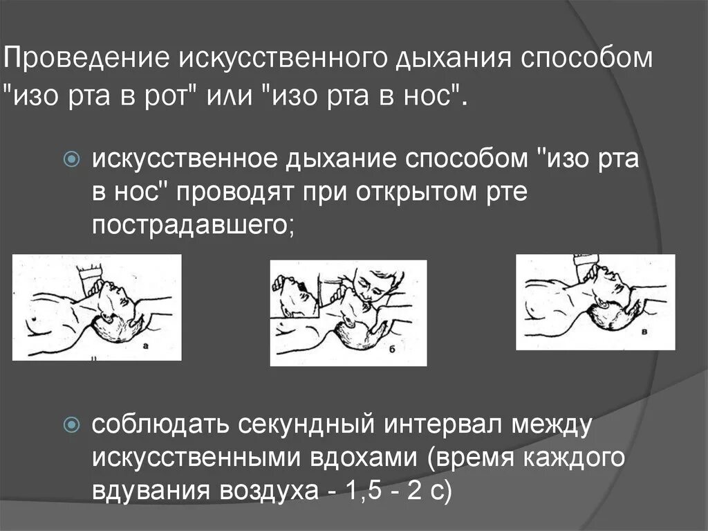 Способы проведения искусственного дыхания изо рта в нос. Порядок проведения искусственного дыхания рот в нос. Алгоритм проведения искусственного дыхания