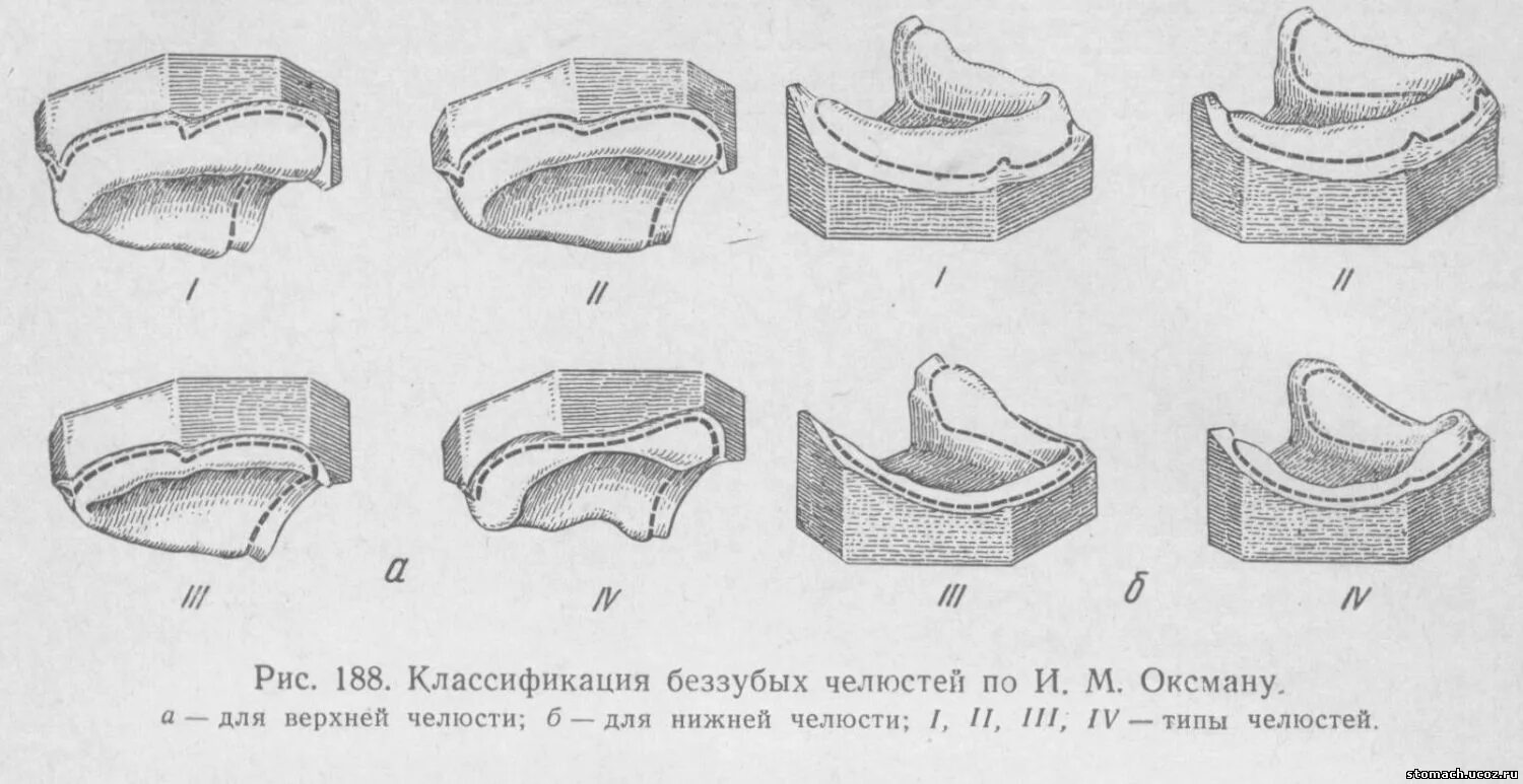 Классификация беззубых челюстей по и.м. Оксману. Классификация беззубых верхних и нижних челюстей по и.м. Оксману. Классификация Шредера беззубых челюстей. Типы атрофии альвеолярных отростков беззубых челюстей по и.м. Оксману. Полная гребня