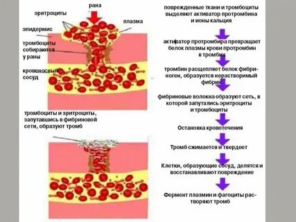 Тромб егэ