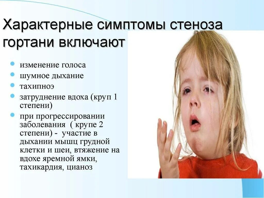 Голоса симптом. Стеноз гортани симптомы. клинические симптомы стеноза гортани. стеноз гортани у детей симптомы. острый стеноз гортани симптомы.