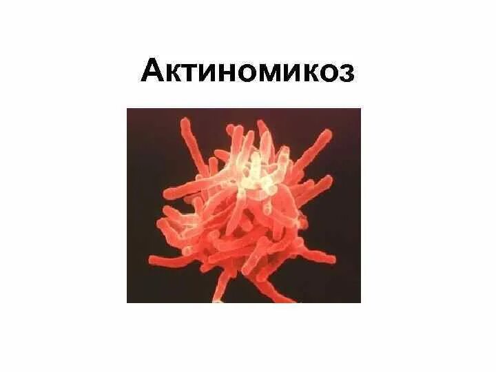 Актиномикоз это. Актиномикоз инкубационный период. актиномикоз возбудитель у животных.
