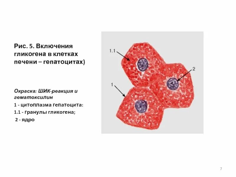 Запасной углевод в клетках печени. Препарат включения гликогена в клетках печени. Включения гликогена в печени гистология. Включения гликогена в клетках печени окраска. Включения гликогена препарат гистология.