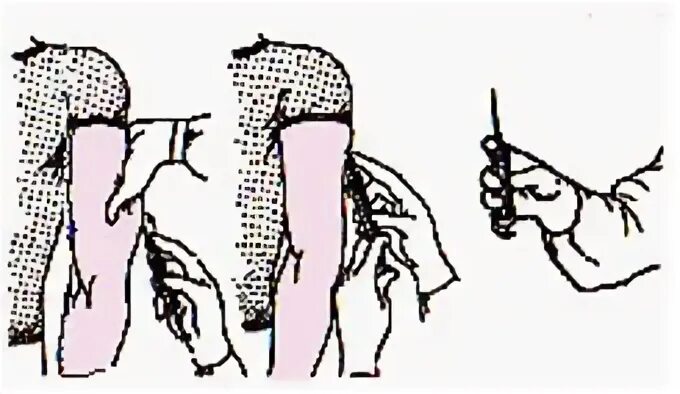 Техника подкожной инъекции алгоритм. Схема техника выполнения подкожной инъекции. Внутримышечная инъекция в плечо техника выполнения. Как правильно сделать укол подкожно. Анатомические области введения инсулина.