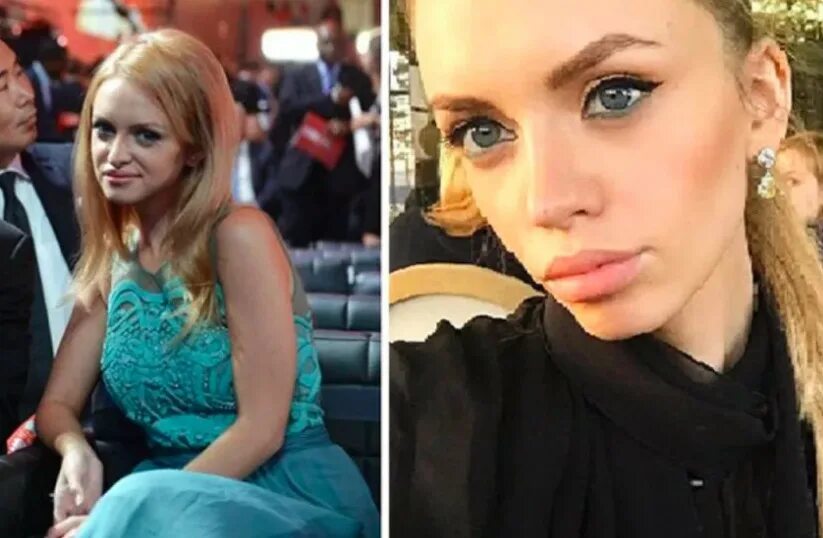 Милана тюльпанова до пластики. Милана кержакова до пластики. Тюльпанова до пластики и после фото. Милана тюльпанова. Милана тюльпанова до и после пластики.