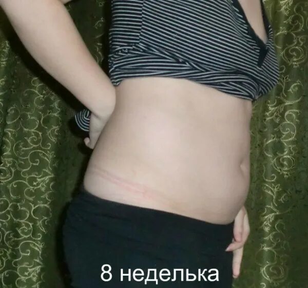 Живот на 8-9 неделе. Какой живот 8 недель. Животик на 8 неделе беременности. Живот на 7-8 неделе беременности. Живот беременной на 8 неделе.