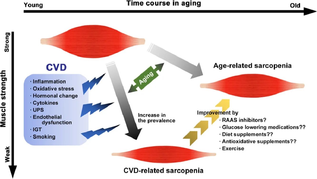 Саркопения у пожилых лечение отзывы. Саркопения. Саркопения у пожилых. Саркопения картинки. Саркопения у женщин.