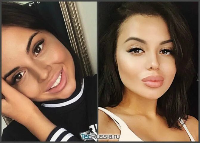 Шафеева до и после пластики Яна шафеева фото