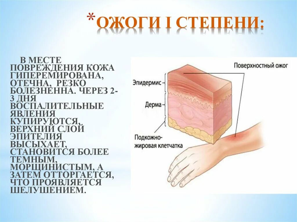 Как выглядит химический ожог на лице Признак термического ожога первой степени