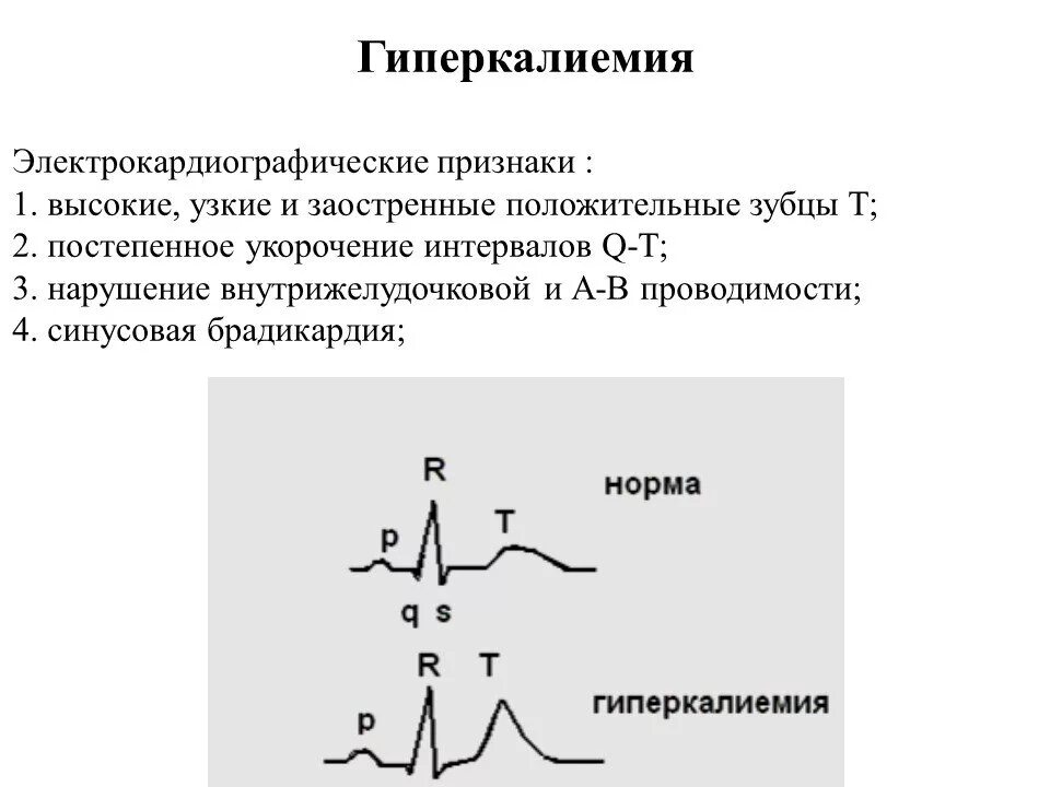 Гиперкалиемия что. ЭКГ признаки гиперкалиемии ЭКГ. Гиперкалиемия и гипокалиемия симптомы. Основные клинические проявления гиперкалиемии. Гипокалиемия на ЭКГ.