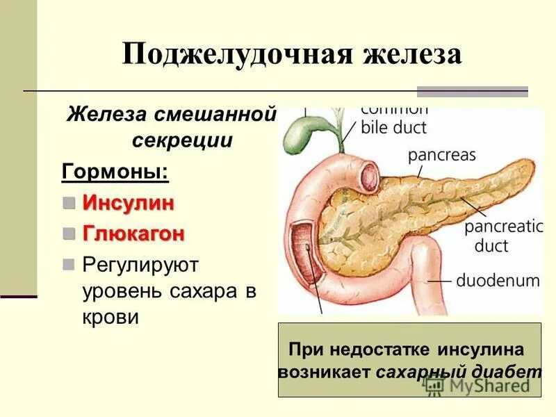 Сахарный диабет 1 типа поджелудочная железа. Сахарный диабет анатомия поджелудочной железы. Поджелудочная железа при сахарном диабете 1 типа. Сахарный диабет 2 поджелудочная железа.