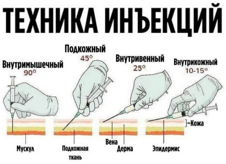 Как делается вид