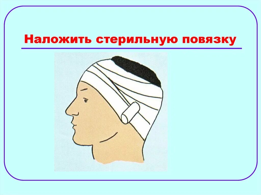 Теплоизолирующая повязка при отморожении. Наложение повязок при отморожениях. наложение повязки при обморожении. повязка на голову обж. на голову накладывают повязку.