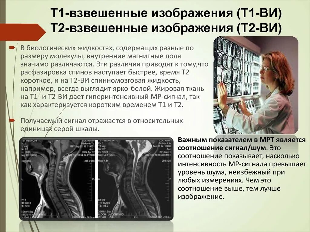 Как описывается мрт. Мрт т1 и т2 режимы что это. магнитно резонансные изображение т2. т1 взвешенные изображения в мрт. интенсивность изображения в магнитно резонансной томографии.