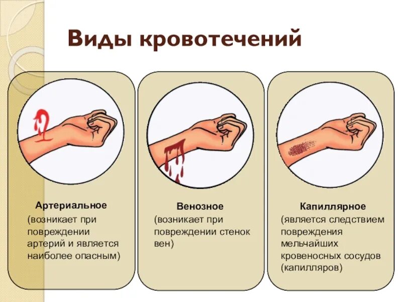 Что делать чтобы рана быстрее