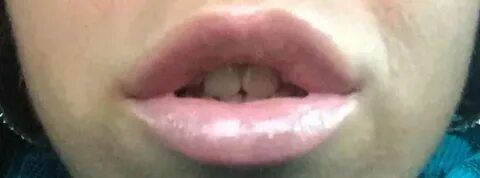 Почему нет нижних мест