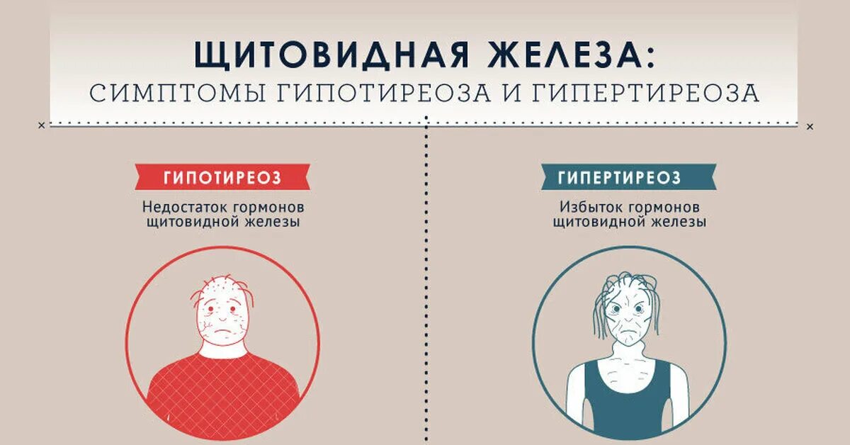 Гиперфункция щитовидной железы симптомы. Симптомы гормоны щитовидной железы гипертиреоз. Гипотиреоз и гипертиреоз щитовидной железы. Симптомы гопотоериоза. Как жить без щитовидной железы