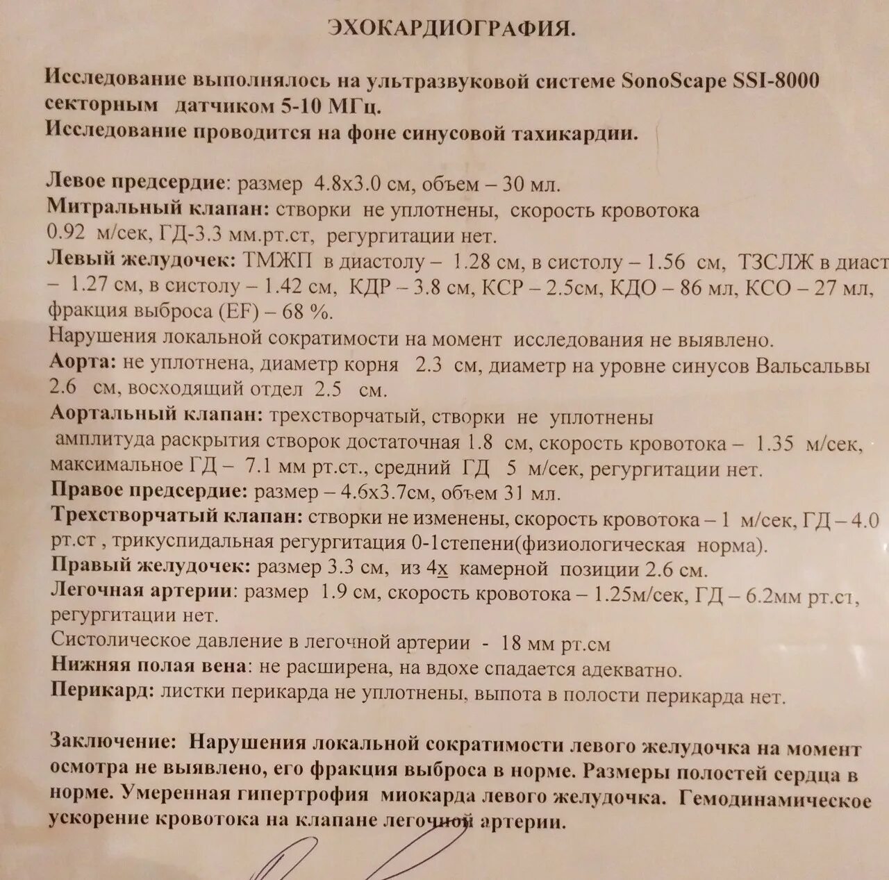 Эхокардиография с допплеровским анализом. Эхокардиография сердца. Эхокардиография методика проведения. Эхокардиография (узи сердца / эхо кг). Узи сердца картинки.