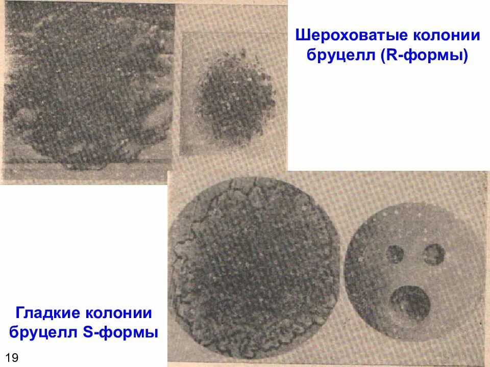 S r формы. Колонии s и r формы. шероховатые формы колоний. шероховатые колонии. r форма колоний.