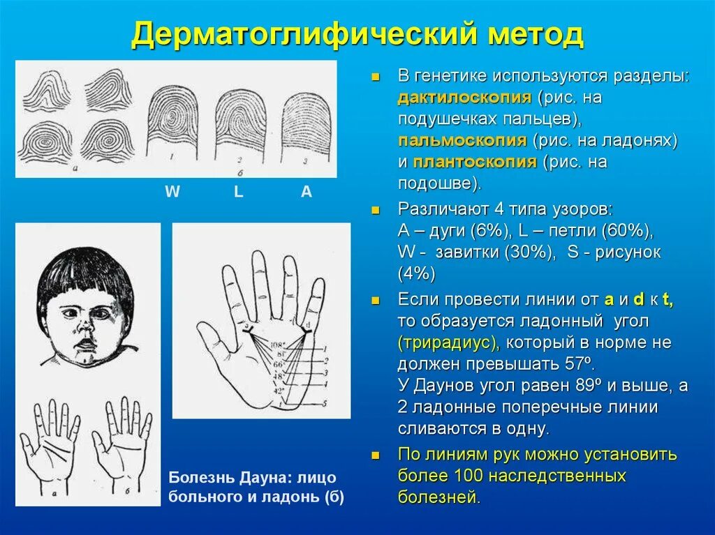 Метод отпечатков пальцев. Дерматоглифический синдром дауна. дерматоглифика. метод дерматоглифики в генетике. пальцевые узоры дерматоглифика.