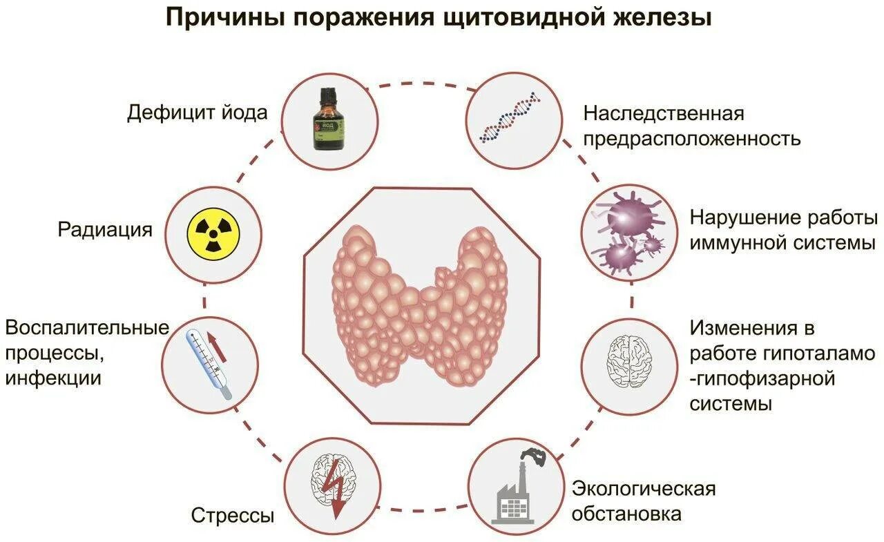 Недостаток йода может привести к развитию ответ. Факторы риска заболеваний щитовидной железы. Заболевание вызванное нарушением функции щитовидной железы. Заболевание, при недостаточном функционировании щитовидной железы.. Факторы риска развития заболеваний щитовидной железы.