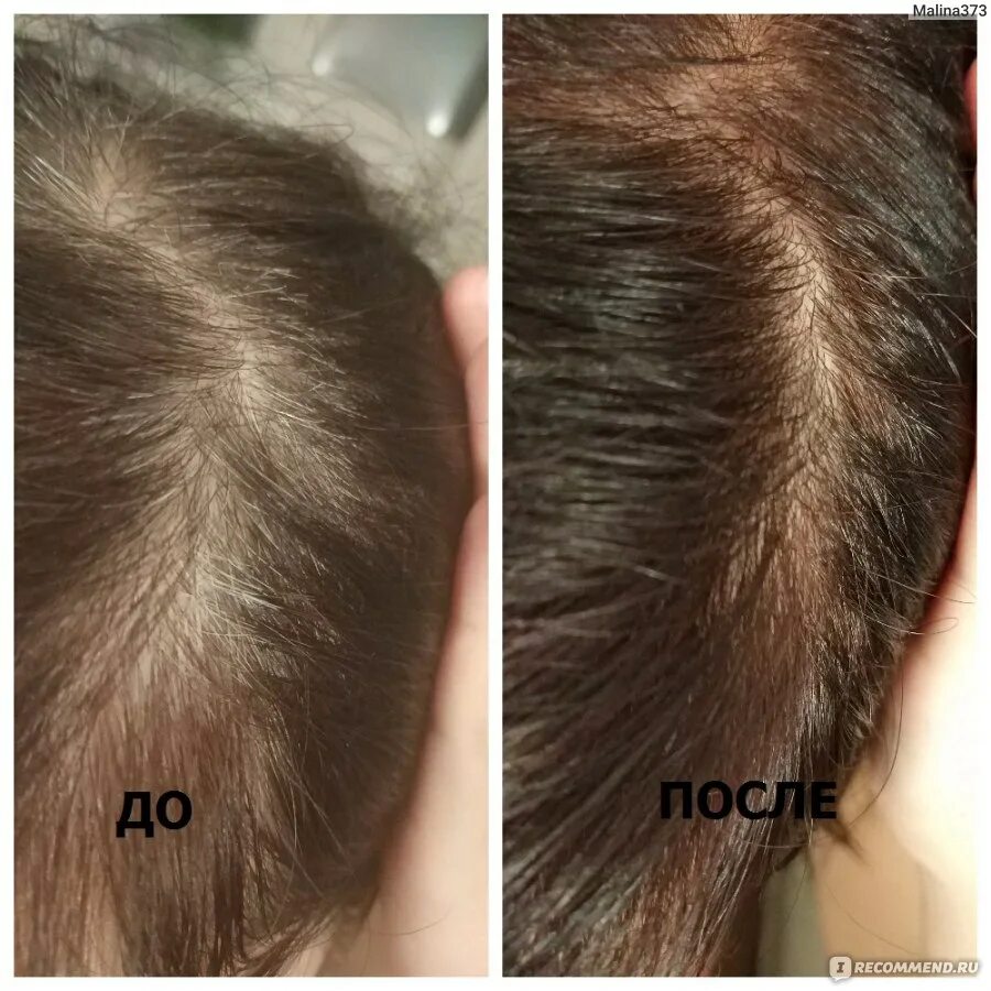 Matrix седина. Matrix 506 n socolor краска. Краска для волос матрикс для седых волос палитра. Matrix extra coverage краска. Coverage 508na.