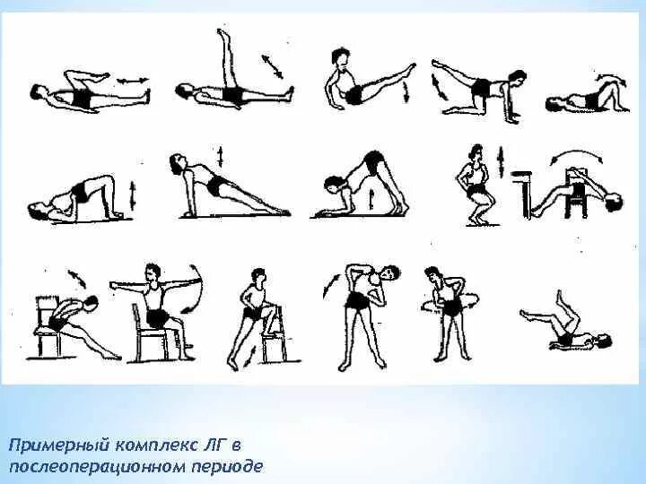 Какие после операции упражнение. Лечебная физкультура при пупочной грыже. Комплекс упражнений ЛФК после операции пупочной грыжи. Лечебная гимнастика при паховой грыже. Лечебная физическая культура в послеоперационный период.